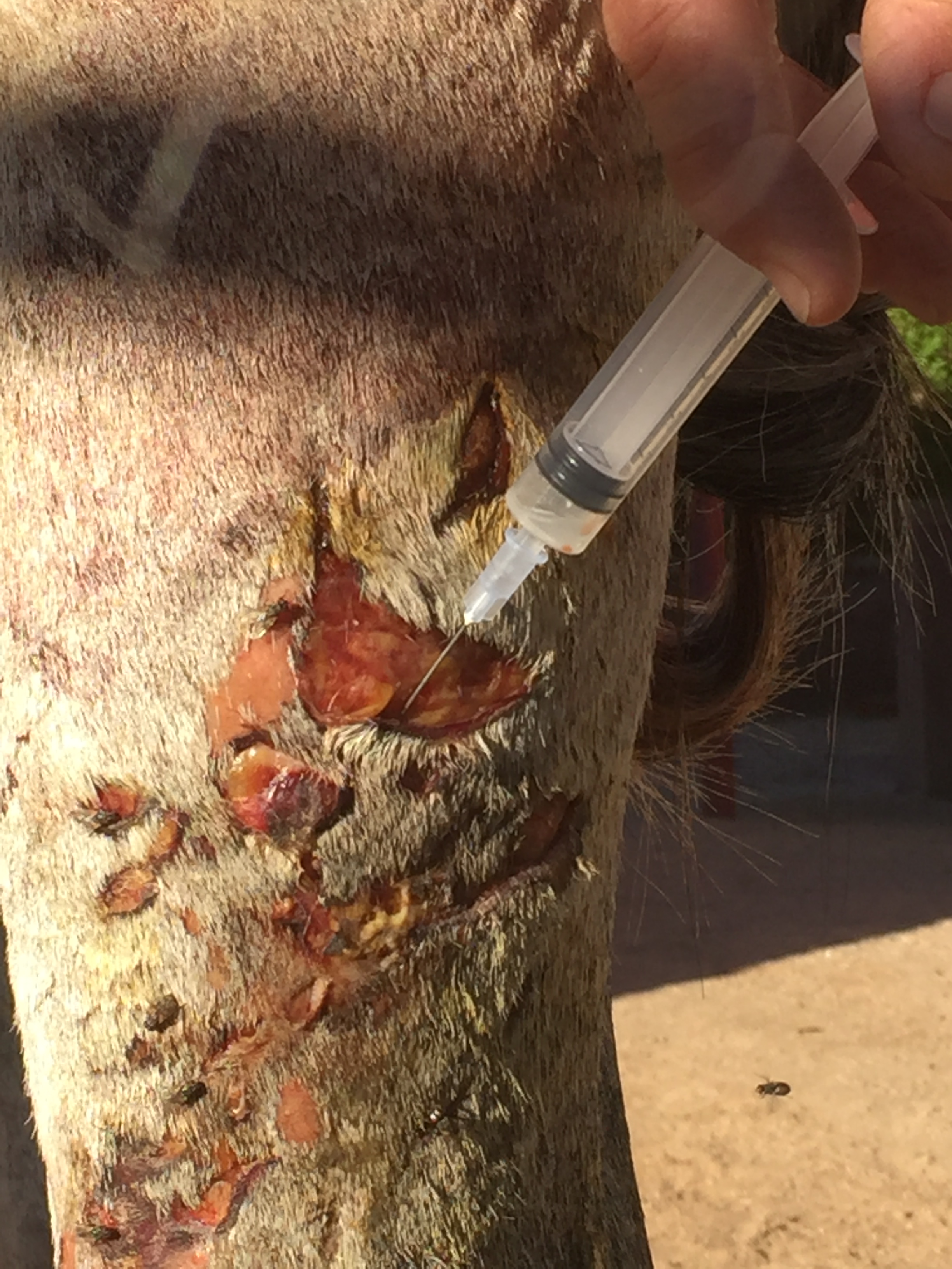 11/12/15 - Treatment of Distal-limb leg wound with AniCell's StemWrap Plus Regenerative Product