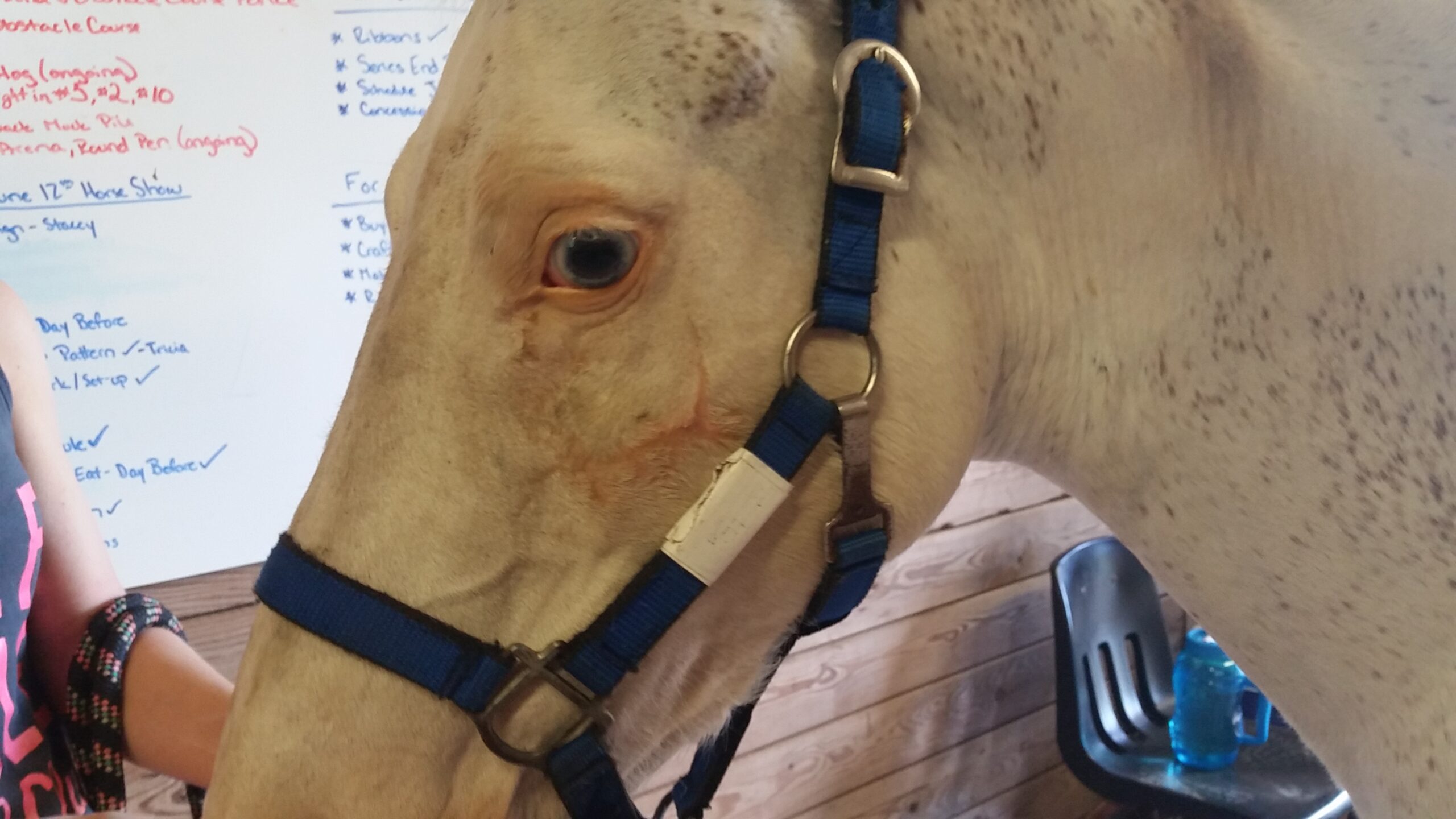 Post pictures of facial bone fracture after use of AniCell StemWrap Amnion treatment