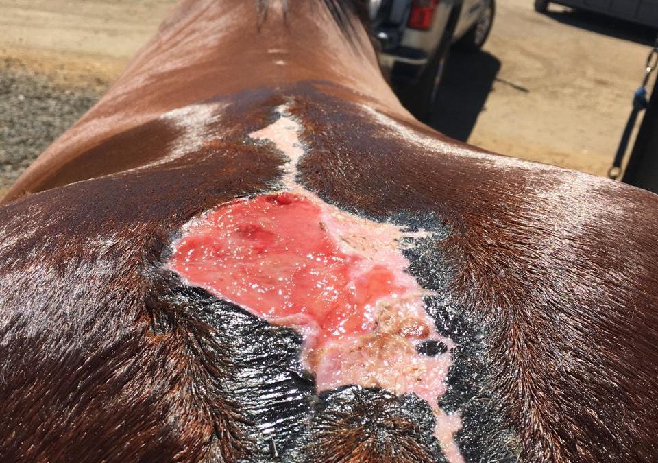 Chemical Burn after Colic Surgery