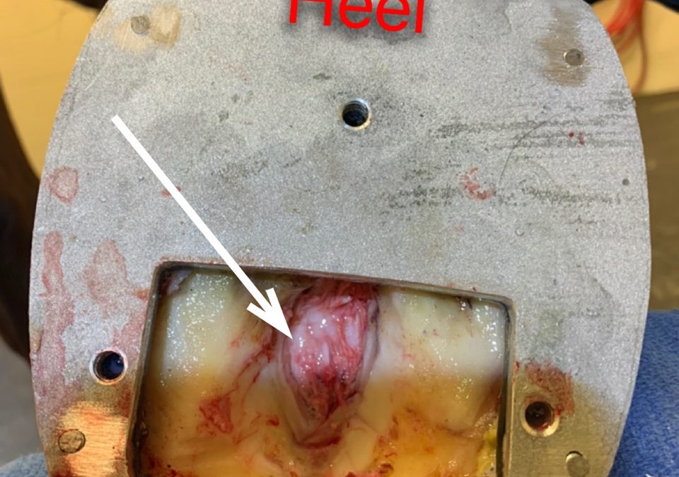 Exposed Tendon in Hoof